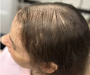 Tape Extensions – före