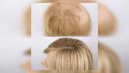 Boka Luxury Mesh Isättning 40 - 50cm - Fairwithhair