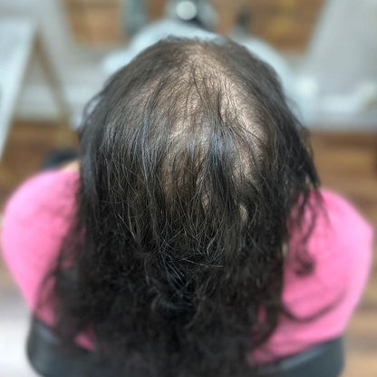 Mesh Hårförlängning - Fairwithhair